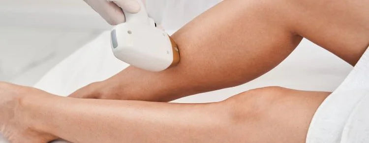IPL haire removal on legs