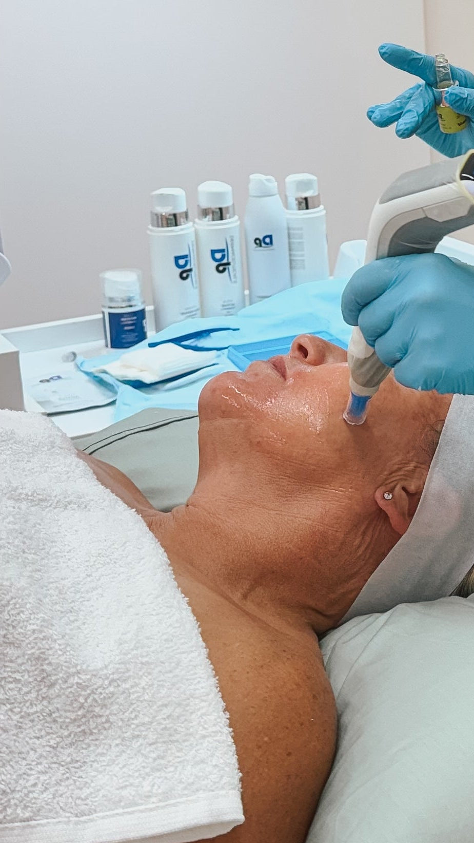 Skin needling session