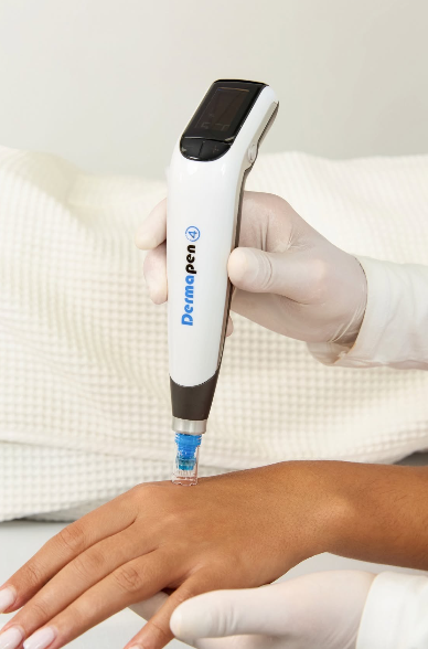 dermapen skins needling treatment on hands